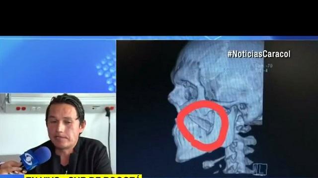 Foto: Secretaría de Salud