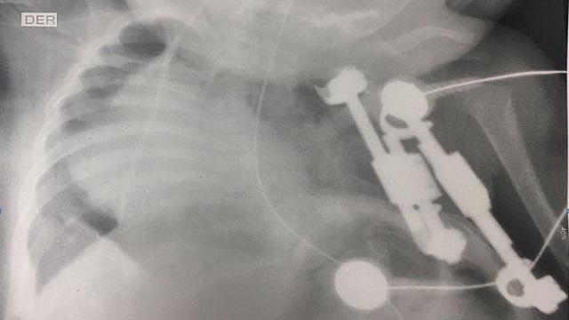 Foto: Secretaría de Salud Foto: Secretaría de Salud