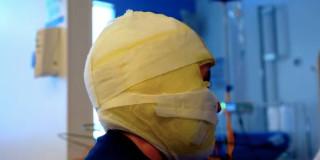 Foto de un menor de edad víctima de quemaduras con pólvora en Bogotá.