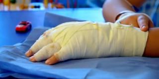 Foto de un menor de edad víctima de quemaduras con pólvora en Bogotá.